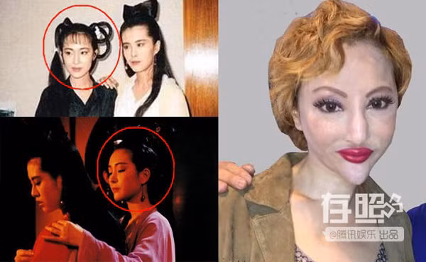 "Thảm họa dao kéo" Tiết Chỉ Luân từng có khuôn mặt rất thanh tú vàtạo thiện cảm cho khán giả - nhất là thời điểm cô đóng "Thiện nữ u hồn". Tuy nhiên, theo thời gian, giờ cô trông quái dị với chiếc mũi khoằm, môi sưng phồng, cằm nhọn hoắt. anh-qua-khu-gay-ngac-nhien-cua-cac-tham-hoa-cbiz-2
