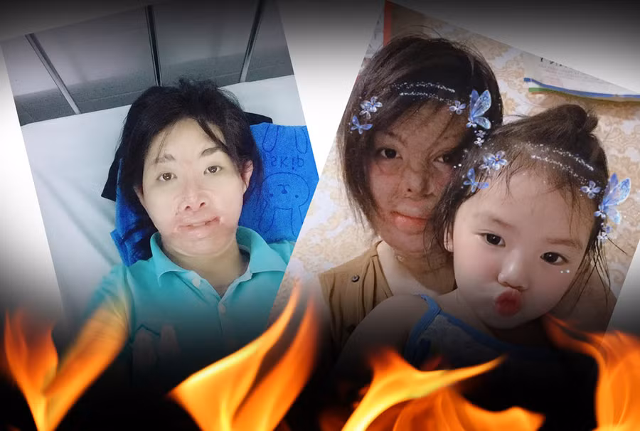 Hai cô gái xinh đẹp bị chồng thiêu sống: Đớn đau tìm lại hình hài tươi sáng - ảnh 4