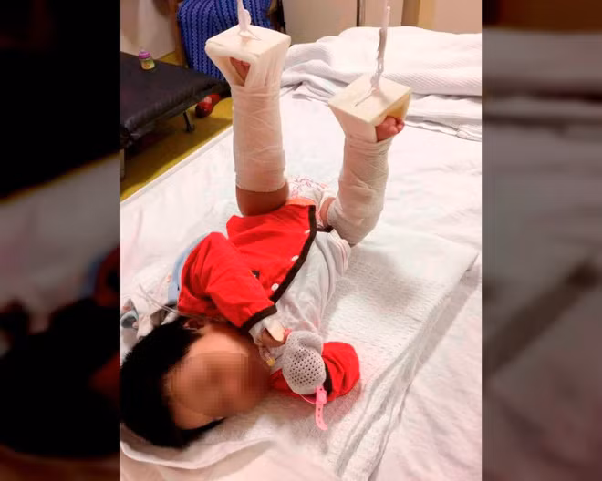 Thấy con cứ khóc mãi sau khi đón từ nhà bảo mẫu về, bố đưa đi khám và sốc khi nhận kết quả - Ảnh 1.