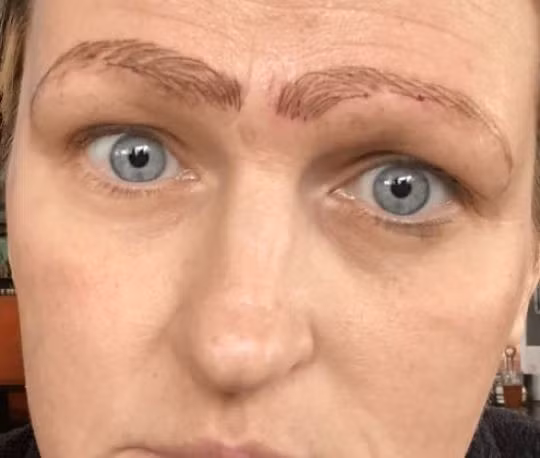 Ham của rẻ đi xăm chân mày, mẹ đơn thân khóc thét khi nhận về kết quả, tiền chữa gấp 4 lần tiền xăm lại còn bị bạn trai đá - Ảnh 2.