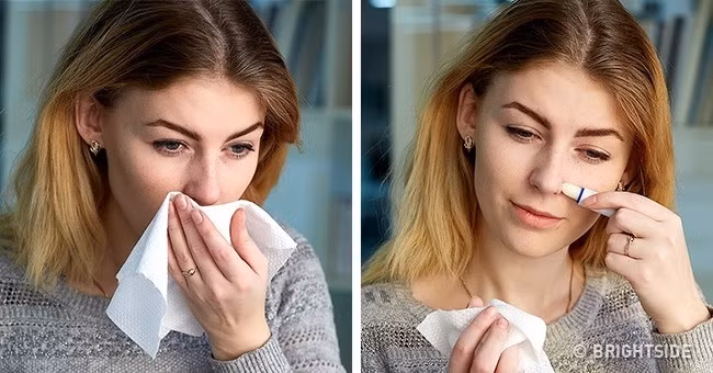 Giảm mẩn đỏ ở mũi khi thời tiết thay đổi.