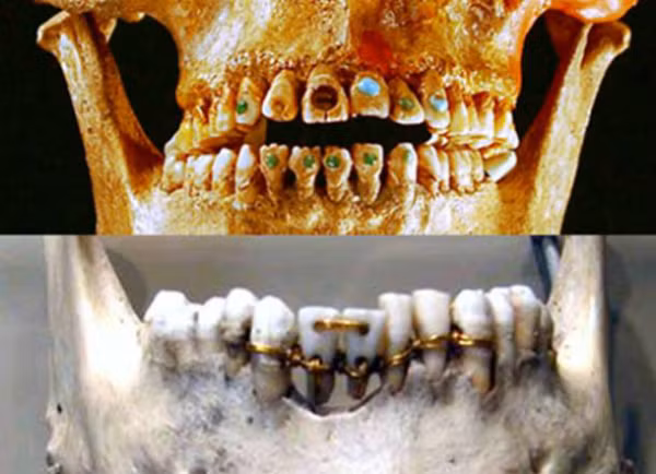 Răng nạm ngọc và răng xỏ dây vàng được thực hiện dưới bàn tay lành nghề của nhữngthợ thủ công thời cổ đại. Ảnh: AO