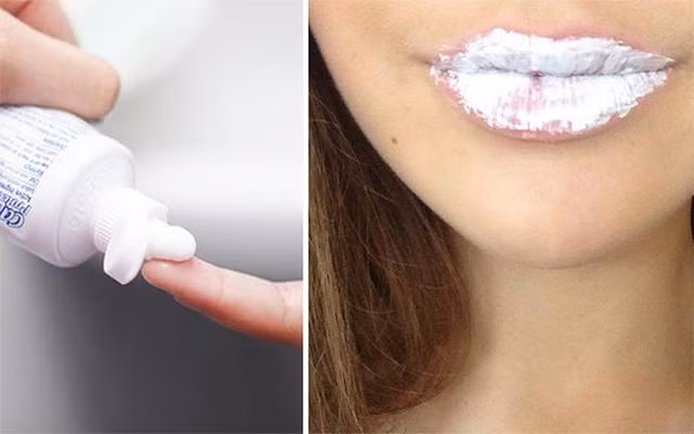 Cách trị thâm môi tại nhà nhanh nhất từ nguyên liệu thiên nhiên dễ kiếm-1