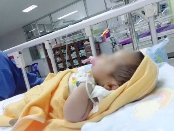 [Cảnh báo] Bé 20 ngày tuổi nhập viện cấp cứu chỉ vì uống nước lọc