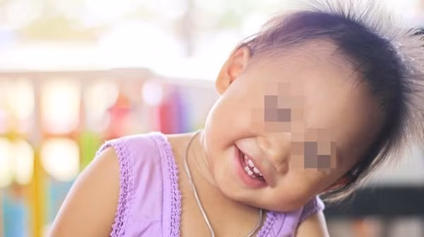 Vì sao trẻ con hay tự giật tóc của mình?