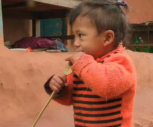 Bé trai Nepal mọc cánh tay ở... lưng - Hình 1