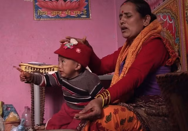 Bé trai Nepal mọc cánh tay ở... lưng - Hình 6
