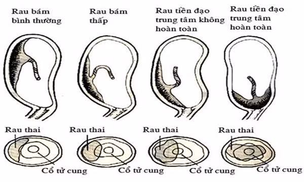 me bau dong nai nhap vien cap cuu, bac si cang nao khi nhin vao tu cung san phu - 2
