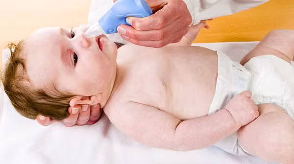 Tác hại khôn lường của việc lạm dụng thuốc nhỏ mũi cho trẻ ảnh 2 mui 1