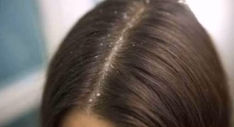 bo tui 8 bi kip ngan ngua gau hieu qua trong mua hanh kho hinh 5