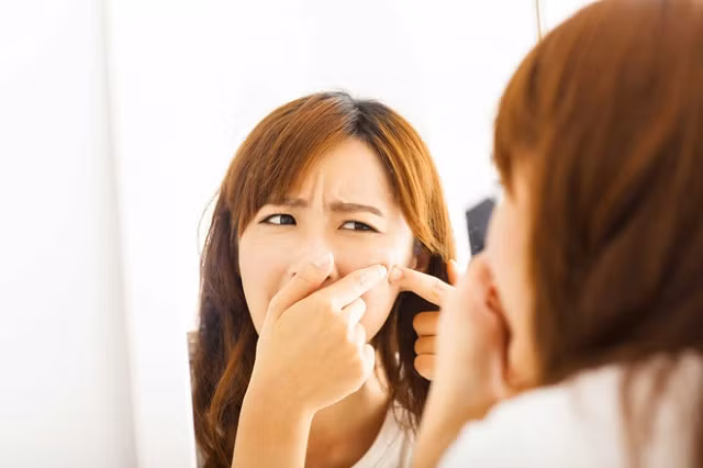 Lưu ý ngay những điều sau để việc nặn mụn không gây ra những hậu quả nghiêm trọng - Hình 2