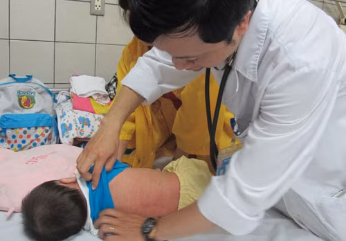 Con đường lây lan bệnh sởi
