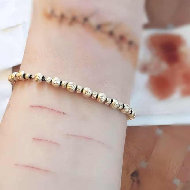 Thiếu nữ được nhà bạn trai đưa đi bệnh viên sau khi tự rạch tay. Ảnh: FBNV. Co gai Sai Gon dung dao lam rach tay vi bi ban trai phan boi hinh anh 2