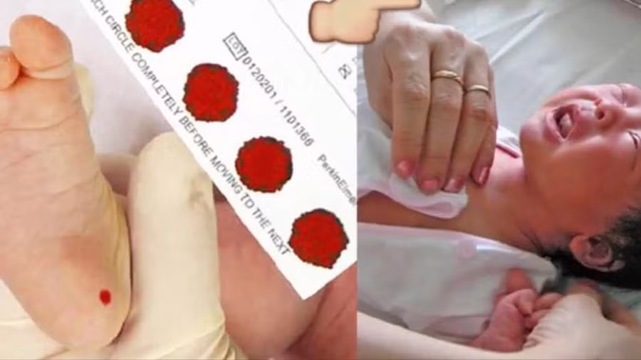 Sức khỏe - Bác sĩ sản khoa giải thích vì sao phải lấy máu gót chân trẻ sơ sinh (Hình 2).