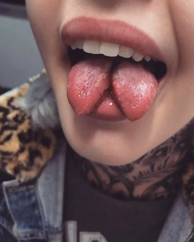  Kinh dị cách làm đẹp chẻ lưỡi ra làm đôi, kéo dài dái tai của cô gái vốn đã xinh đẹp 