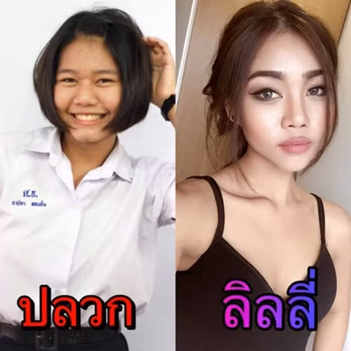 Cô gái có vòng eo 46 cm gây sốt cộng đồng mạng sau phẫu thuật thẩm mĩ ảnh 3