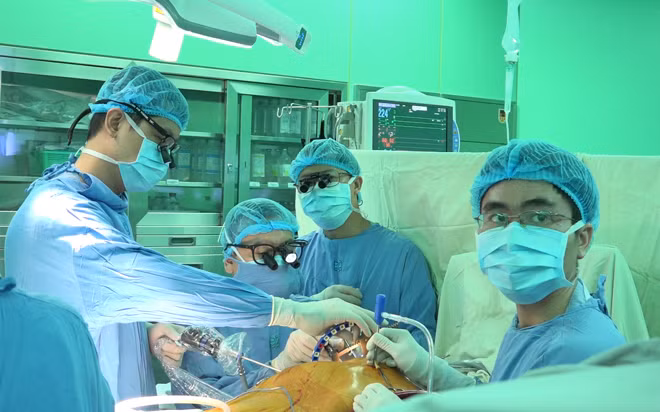 Một ca phẫu thuật nội soi tim tại bệnh viện Đại học Y Dược TP HCM. Ảnh: N.P
