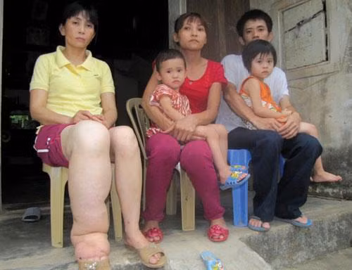 Những căn bệnh “kỳ dị” nhất thế giới mà toàn bộ giới y học cũng phải “bó tay“
