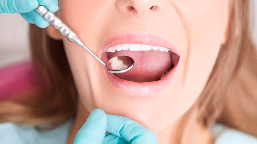 Vệ sinh răng miệng tốt bao gồm khám răng định kỳ, ngăn ngừa sự tích tụ mảng bám bằng cách đánh răng thường xuyên, tránh các thực phẩm giàu carbohydrate và đường. (Ảnh: ITN) Vệ sinh răng miệng tốt bao gồm khám răng định kỳ, ngăn ngừa sự tích tụ mảng bám bằng cách đánh răng thường xuyên, tránh các thực phẩm giàu carbohydrate và đường. (Ảnh: ITN)