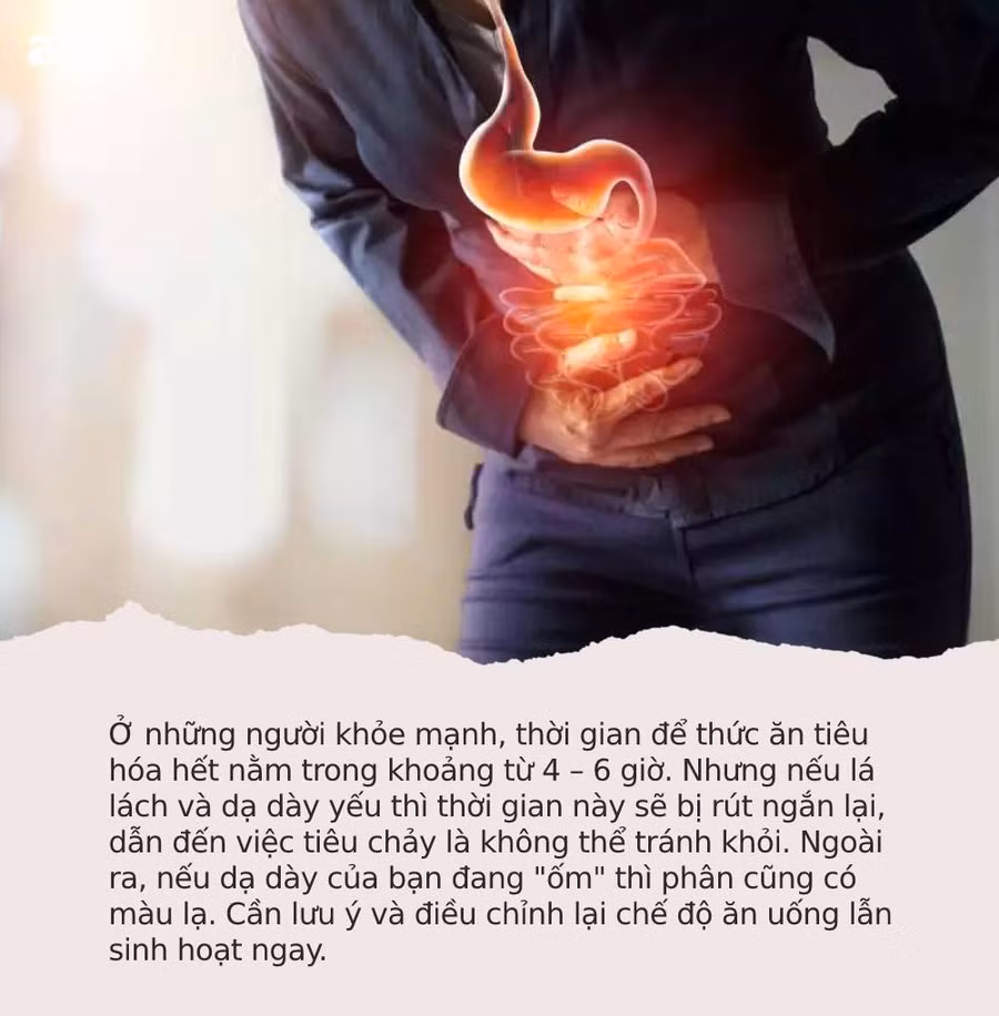 Sau khi ăn mà xuất hiện 4 dấu hiệu này thì đừng chủ quan, dạ dày của bạn đang gặp vấn đề nghiêm trọng rồi - Ảnh 3. Sau khi ăn mà xuất hiện 4 dấu hiệu này thì đừng chủ quan, dạ dày của bạn đang gặp vấn đề nghiêm trọng rồi - Ảnh 3.