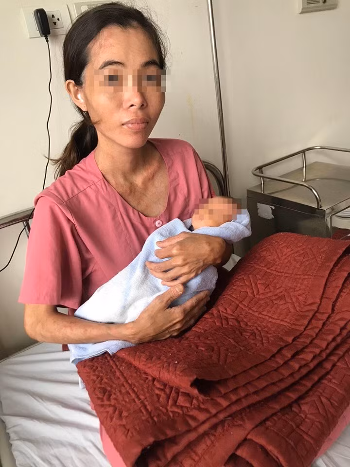 Mẹ con sản phụ sức khỏe đã bình phục hiện có thể xuất viện.