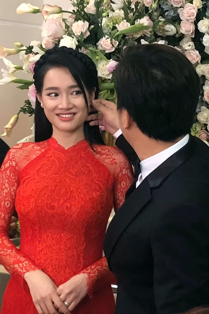Bọng mắt nhăn nheo là khuyết điểm lớn nhất trên gương mặt xinh đẹp của nữ diễn viên.