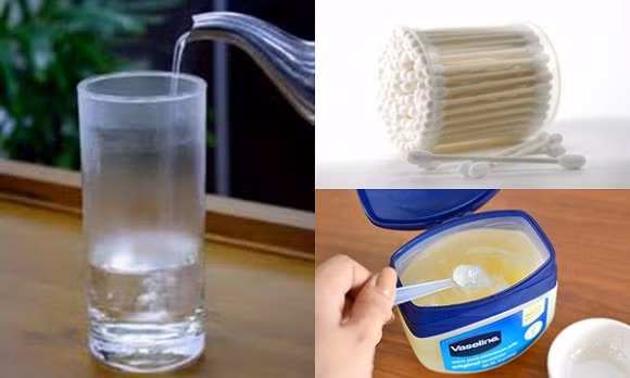 rốn, vệ sinh rốn, làm sạch rốn