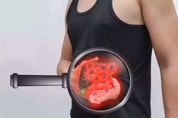Xuất hiện 4 đặc điểm này trên mặt, kiểm tra gan càng sớm càng tốt để khỏi hối hận thì đã muộn-1