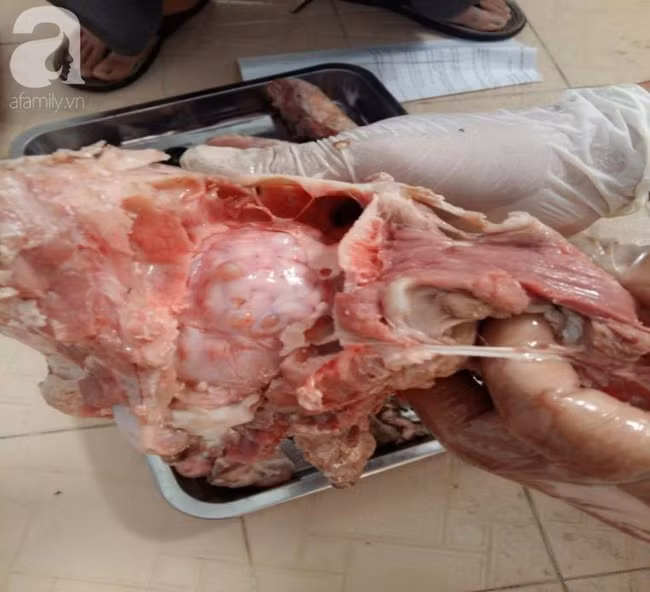 Phát hiện ổ sán dây lợn khiến ít nhất 108 người nhiễm bệnh: Nhiễm sán dây lợn nguy hiểm thế nào? - Ảnh 1.