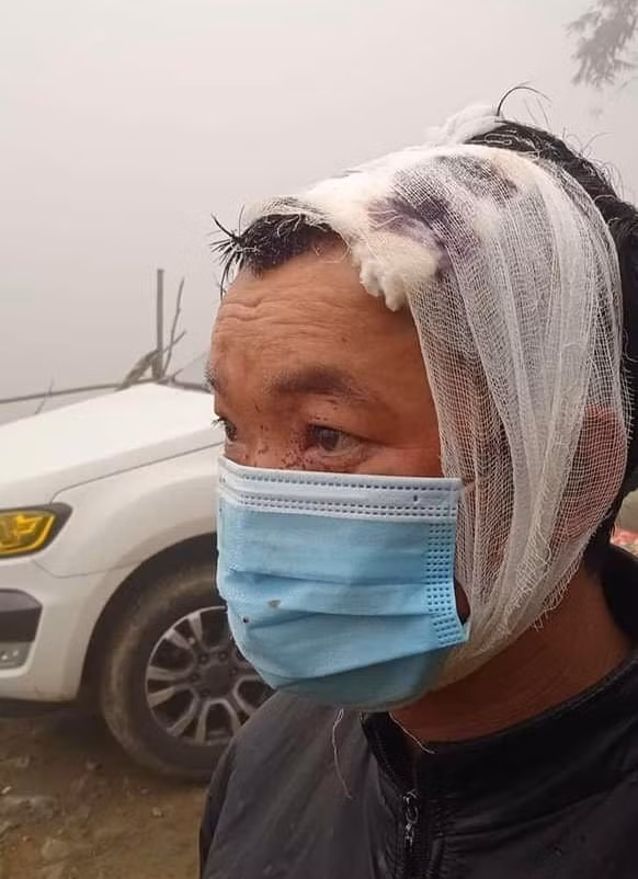 Một trong số những nạn nhân sau cuộc xô xát