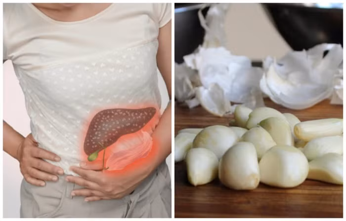 Những người bị bệnh gan, thận suy yếu, sức đề kháng kém cũng không nên ăn tỏi.