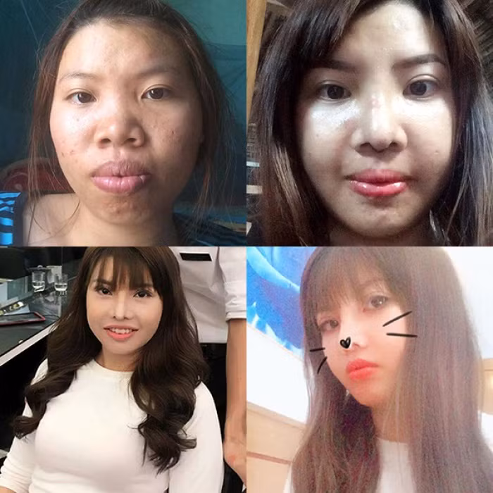 Sự thật bất ngờ gương mặt chằng chịt vết thương của Phượng “Thị Nở tái sinh“ ảnh 1 Hành trình “lột xác” của Quách Phượng.