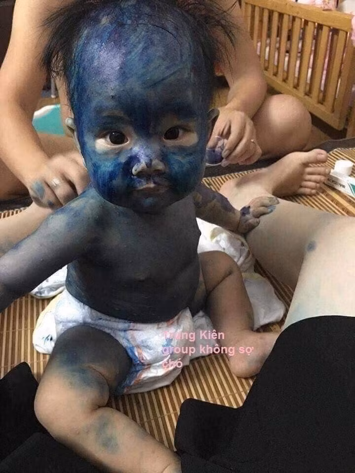 Bôi nhầm còn hơn bỏ xót.