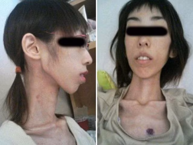 Khuôn mặt gầy guộc tới mức đáng sợ