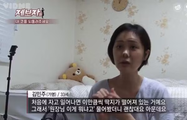 Cô gái sở hữu chiếc mũi kinh dị ảnh 2