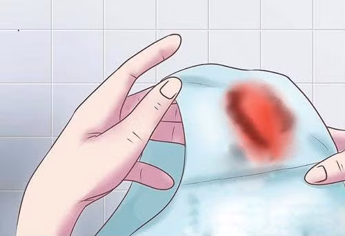 Những dấu hiệu đặc trưng và sớm nhất báo hiệu bạn đã mang thai ảnh 2