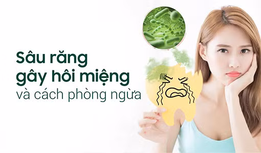 Sâu răng gây hôi miệng không thể cải thiện bằng vệ sinh răng miệng thông thường.