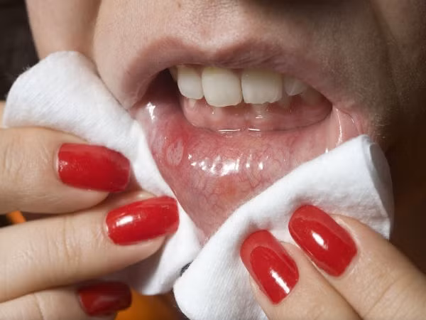 Miệng nhiều nước bọt nguyên nhân do đâu?