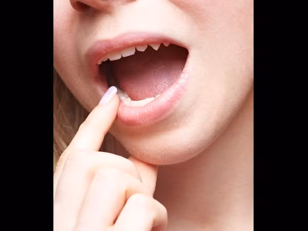 Miệng nhiều nước bọt nguyên nhân do đâu?