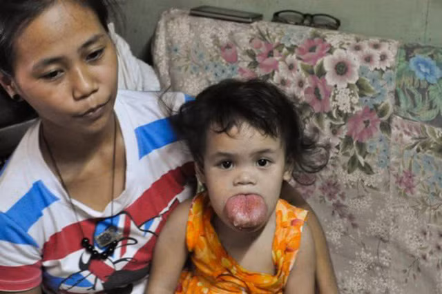 Gia đình Zhyzille tương đối nghèo