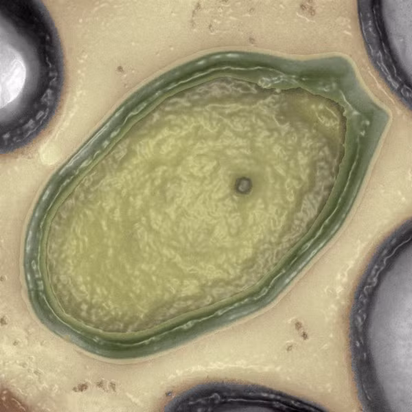 Pandoravirus được tìm thấy vào năm 2003 với 2.500 gene khác nhau. Pandoravirus được tìm thấy vào năm 2003 với 2.500 gene khác nhau.