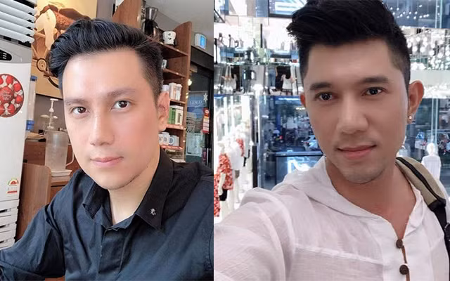 Sau phẫu thuật thẩm mỹ, Việt Anh nhìn na ná giống một người