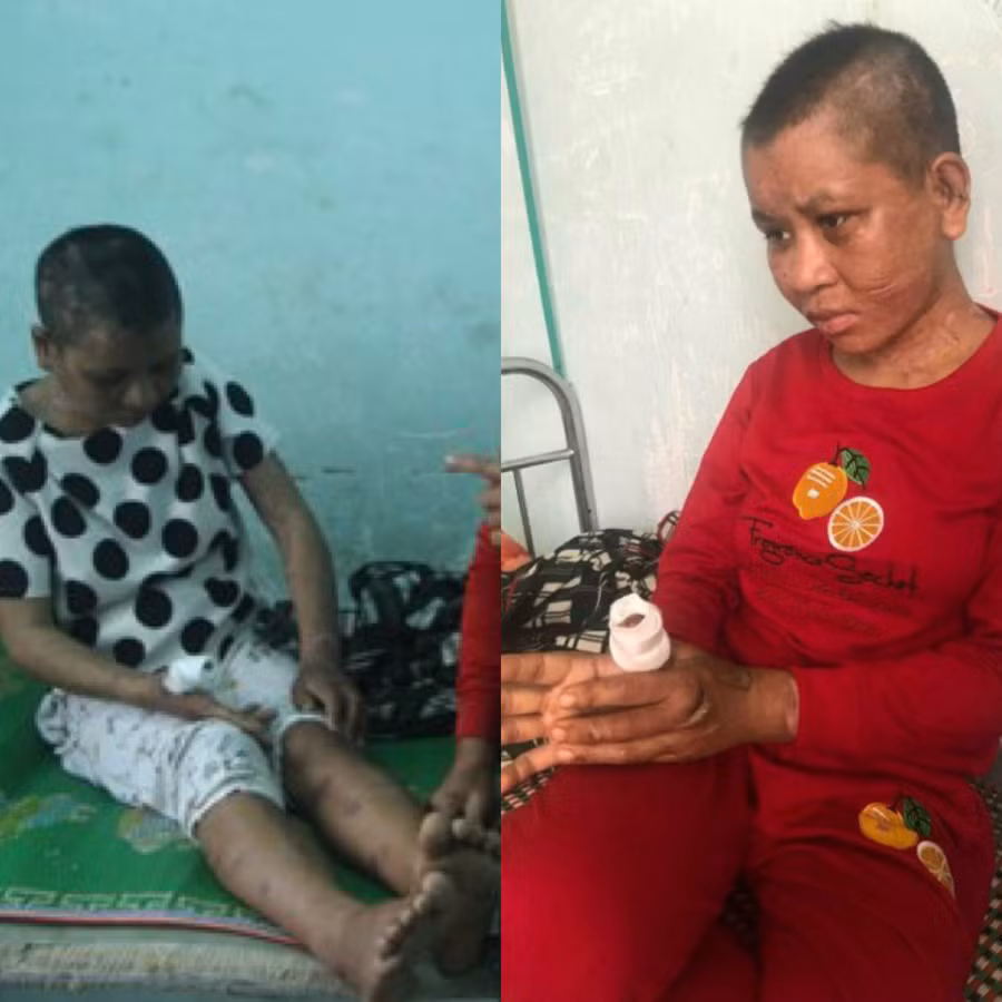 Rùng mình lời kể của người giúp việc bị tra tấn dã man như thời trung cổ