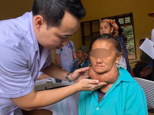 Các bác sĩ phát hiện người phụ nữ có khối u khổng lồ trong đợt khám tình nguyện tại Sơn La