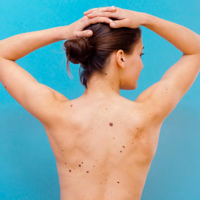 Những dấu hiệu cảnh báo ung thư bạn không nên bỏ qua