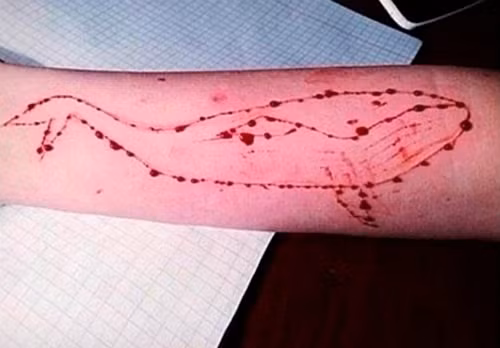 Bọn trẻ tự làm đau mình khi chơi trò The Blue Whale - Ảnh:The Sun. be-5-tuoi-bi-bong-nang-vi-tro-lua-dao-tren-mang-2