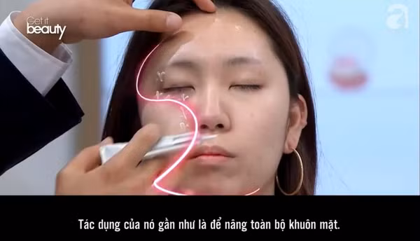 Ảnh minh họa. 