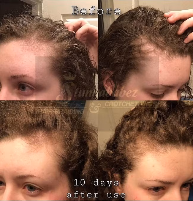 rice-water-effect-on-hair-bumf01rh1sb-15770789825971554923187