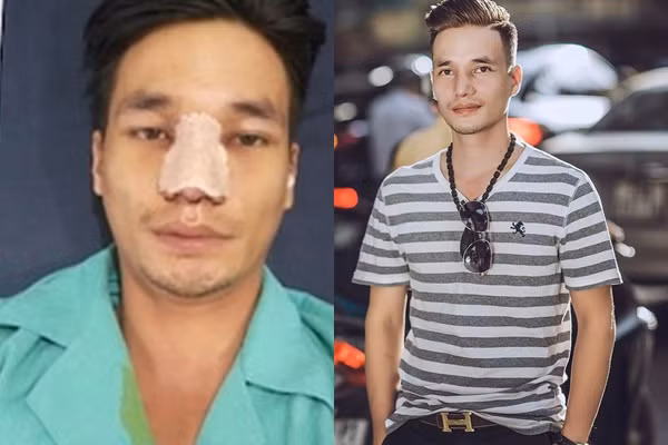 Sau phẫu thuật thẩm mỹ anh gây ấn tượng với ngoại hình ngày càng được cải thiện.