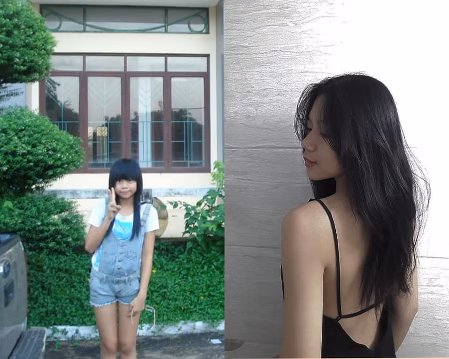 Bị bạn học trêu chọc là xấu xí, cô gái đợi đến 19 tuổi để phẫu thuật thẩm mỹ thành hot girl-8